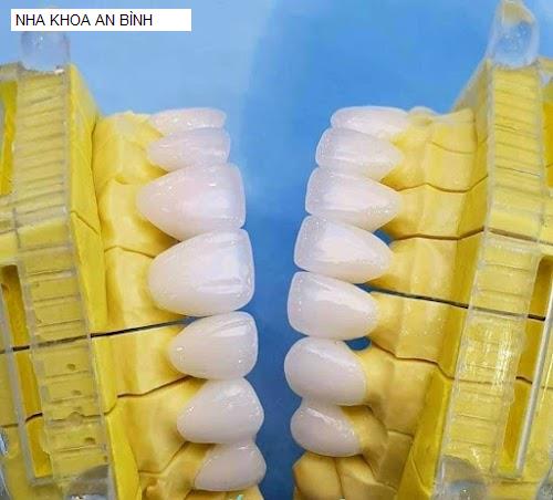 Hình ảnh NHA KHOA AN BÌNH